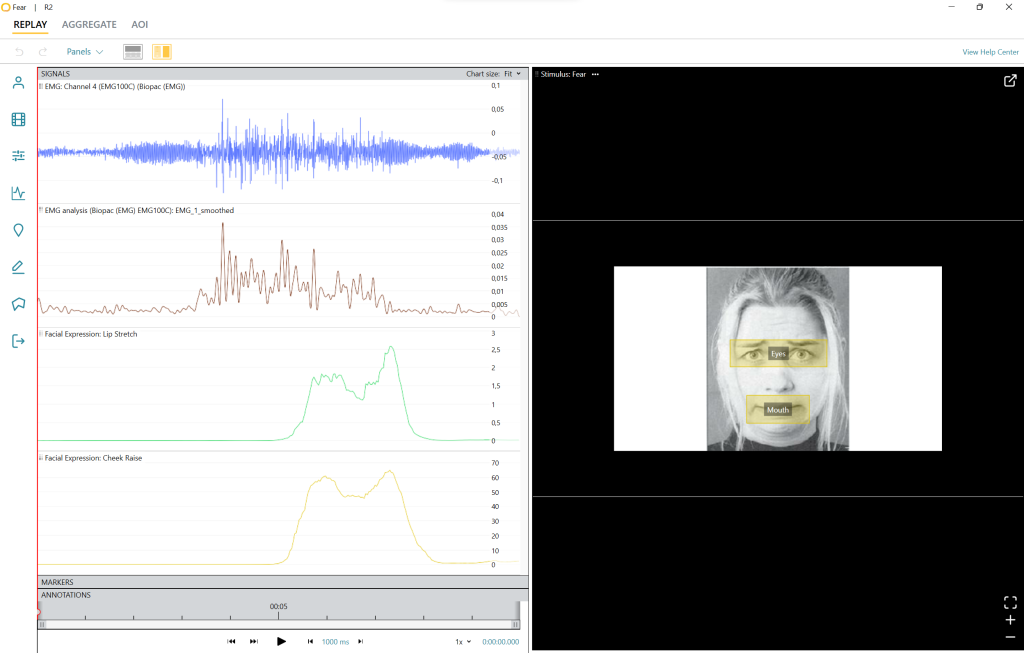 Facial mimicry electromyography