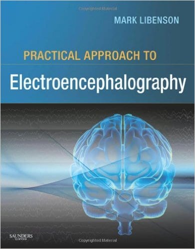 Practical approach to electroencephalography